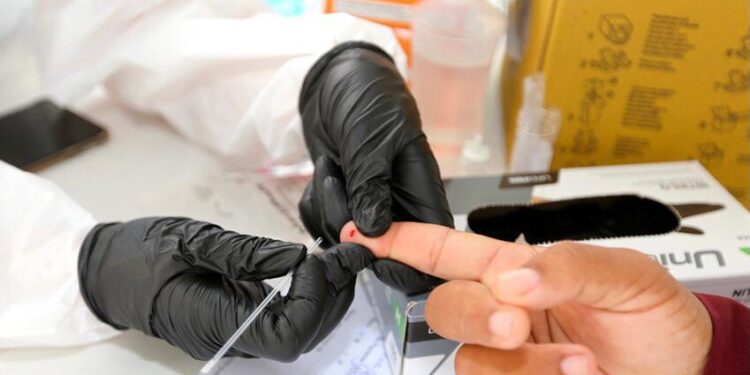 Anvisa autoriza realização de exame de análise clínica em farmácias