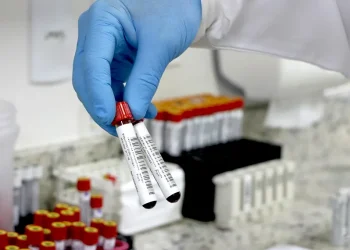 Jejum não é obrigatório para maioria dos exames de sangue