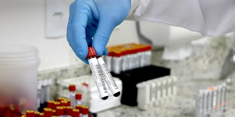 Jejum não é obrigatório para maioria dos exames de sangue