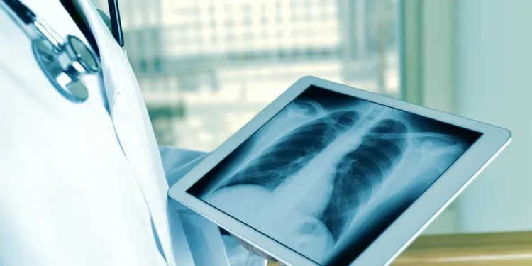 Telerradiologia: tecnologia garante diagnóstico de qualidade