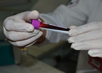 Hemose realiza cadastro de medula óssea em parceria com a UFS