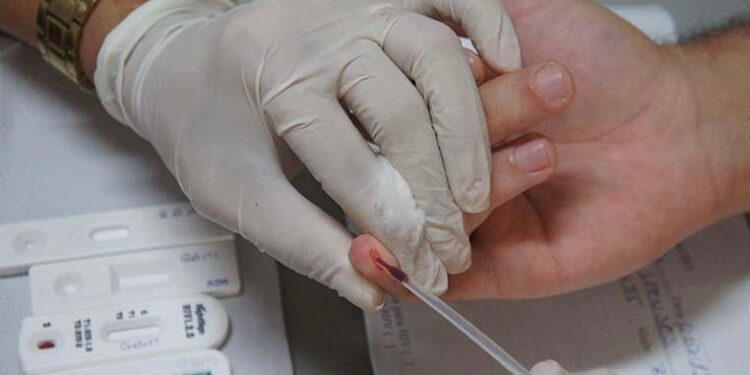 Aracaju oferta prevenção e tratamento contra o HIV na rede municipal de saúde