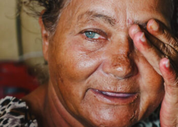 ‘Enxerga Sergipe’ já ultrapassou a marca de 4 mil cirurgias oftalmológicas e resgatou a qualidade de vida de muitos sergipanos