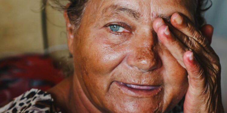 ‘Enxerga Sergipe’ já ultrapassou a marca de 4 mil cirurgias oftalmológicas e resgatou a qualidade de vida de muitos sergipanos