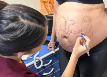 Maternidade Nossa Senhora de Lourdes promove momento interativo com pacientes por meio da arte gestacional