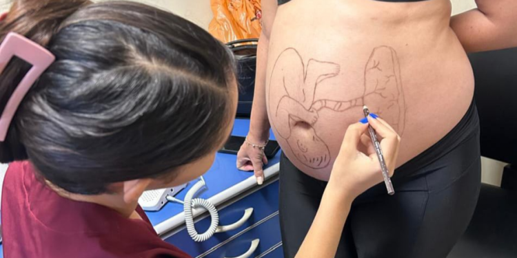 Maternidade Nossa Senhora de Lourdes promove momento interativo com pacientes por meio da arte gestacional
