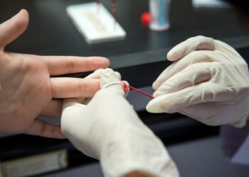 Ministério da Saúde orienta que farmácias realizem testes rápidos de HIV