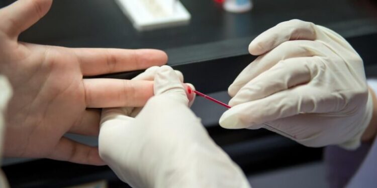 Ministério da Saúde orienta que farmácias realizem testes rápidos de HIV