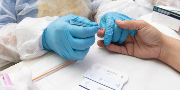 Unidade Móvel ‘Fique Sabendo’ realiza 184 testes rápidos