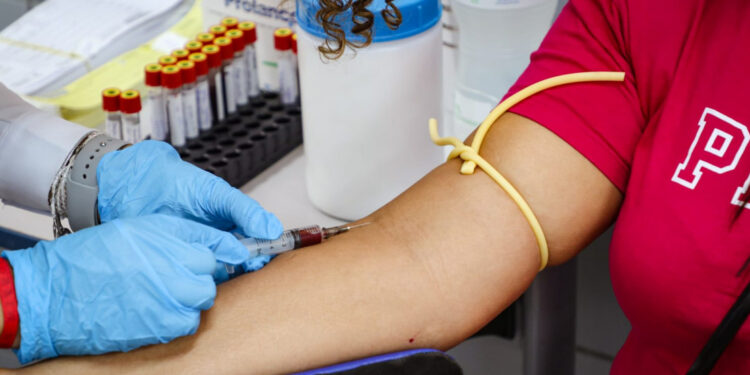 Secretaria da Saúde reforça orientações para combate do vírus HTLV