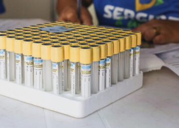 Lacen já realizou mais de 2.500 testes para detecção de câncer de próstata