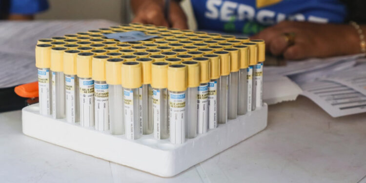 Lacen já realizou mais de 2.500 testes para detecção de câncer de próstata