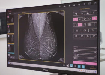 Saúde reforça importância do exame de mamografia para diagnóstico precoce do câncer de mama