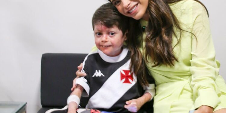 Yandra Moura reforça compromisso com a causa da Epidermólise Bolhosa e avança com novos projetos de lei