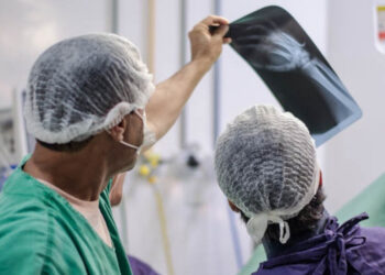 Hospital de Urgências de Sergipe alerta para aumento de lesões ortopédicas no período de Carnaval