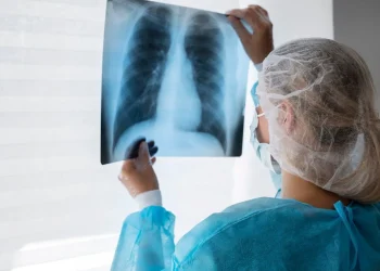 Câncer de pulmão: terapia-alvo reduz em 84% risco de morte