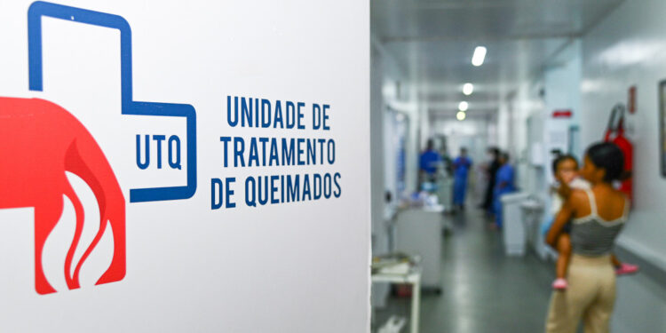 Período junino exige cuidado redobrado com relação aos riscos de queimaduras