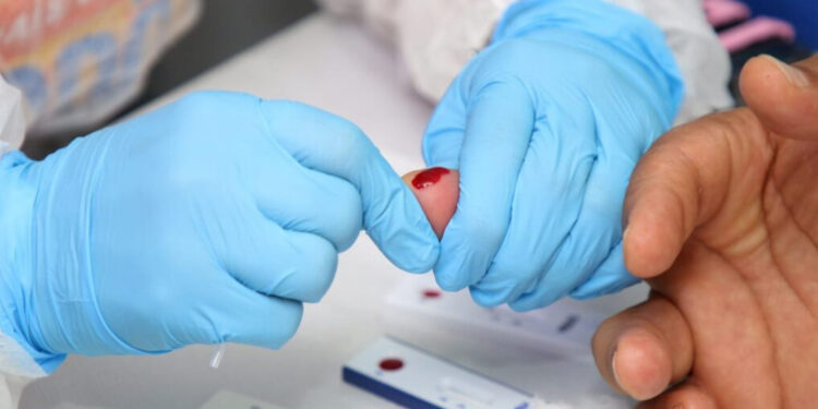 Sergipe avança no controle das hepatites virais e reduz mortalidade por hepatite C