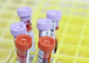 Novo estudo indica que exame de sangue pode prever Alzheimer em fase inicial